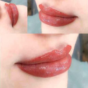 Permanent makeup af læber
